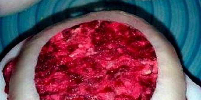 Рецепт фаршированных яиц с сельдью